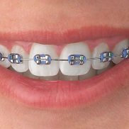 image-list-1 image-list-1