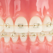 image-list-3 image-list-3