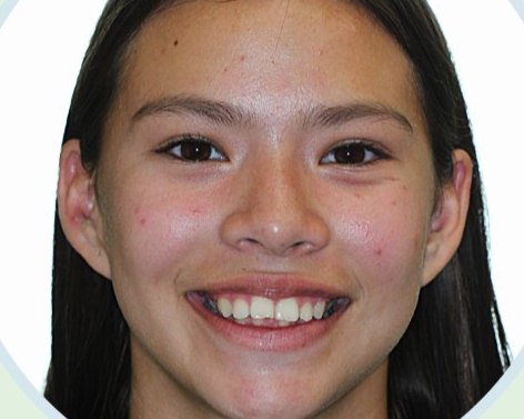 before-neelab before-neelab